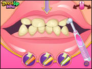 Bad Teeth Makeover