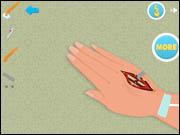 Hand Surgery