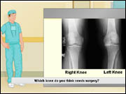 Virtual Knee Surgery